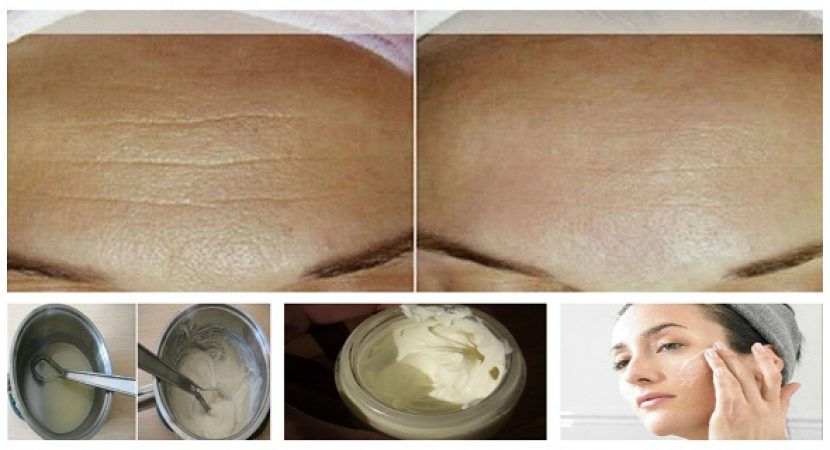 Anti - Aging crema fatta in casa per sbarazzarsi di linee e Wrinkless In Faccia in meno di due Weekd