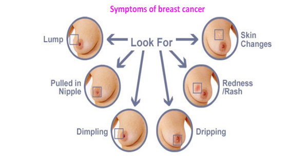 How Can Breast Cancer Be Detected Healthy Food Advice