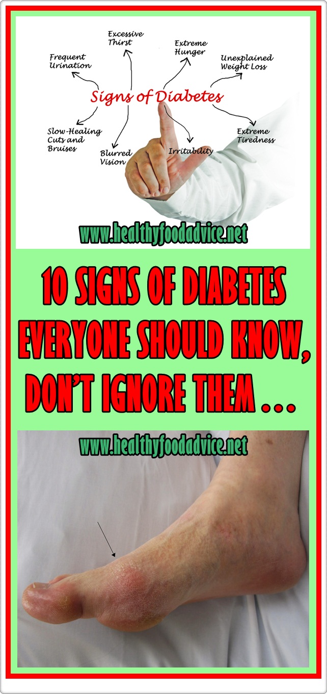 10 Signs Of Diabetes Everyone Should Know Dont Ignore Them Healthy Food Advice 7617