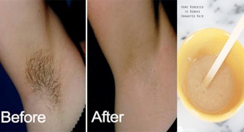 How To Remove Underarm Hair In Just 2 Minutes Simple Natural Solution Healthy Food Advice 